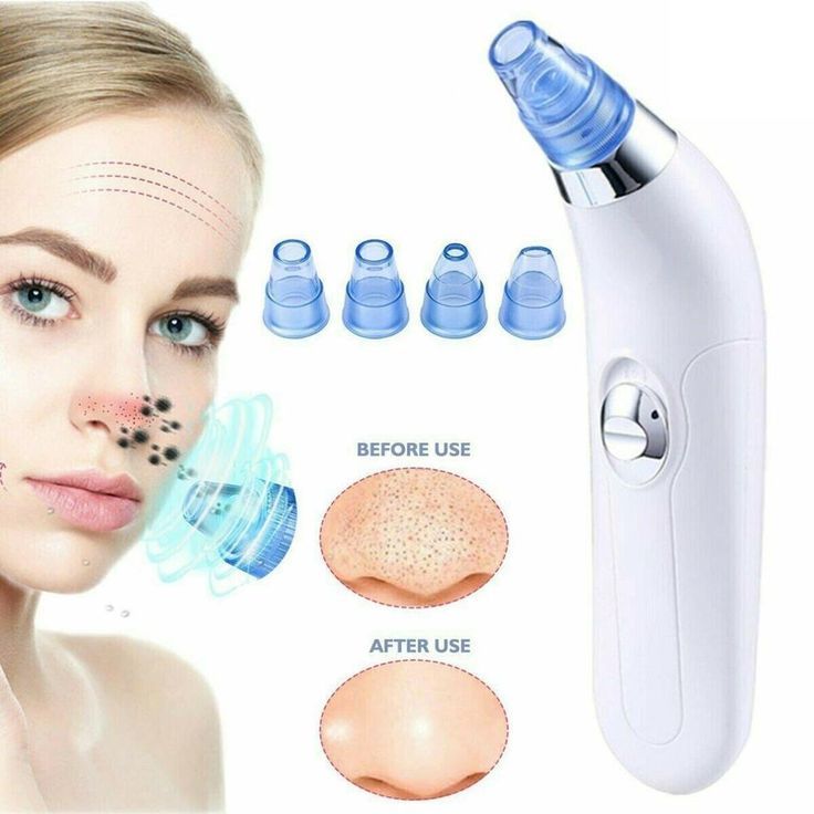 4 in 1 Handy Pore Cleaner
