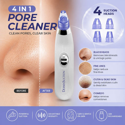 4 in 1 Handy Pore Cleaner